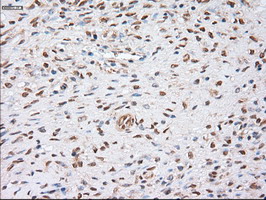 ACTN1 Antibody - IHC of paraffin-embedded Human Ovary tissue using anti-ACTN1 mouse monoclonal antibody.