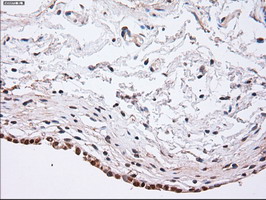 ACTN1 Antibody - IHC of paraffin-embedded Human bladder tissue using anti-ACTN1 mouse monoclonal antibody.