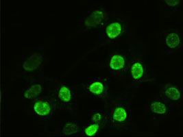ACTN1 Antibody - Anti-ACTN1 mouse monoclonal antibody  immunofluorescent staining of Hela cells transiently transfected by pCMV6-ENTRY ACTN1.