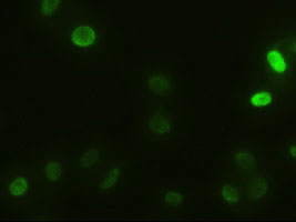 ACTN1 Antibody - Immunofluorescent staining of HeLa cells using anti-ACTN1 mouse monoclonal antibody.