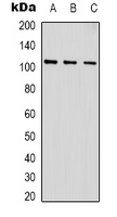 ACTN1 Antibody - Western blot analysis of ACTN1 expression in NIH3T3 (A); PC12 (B); rat heart (C) whole cell lysates.