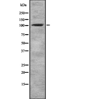 ACTN1 Antibody - Western blot analysis of ACTN1/2/3/4 using COLO205 whole cells lysates
