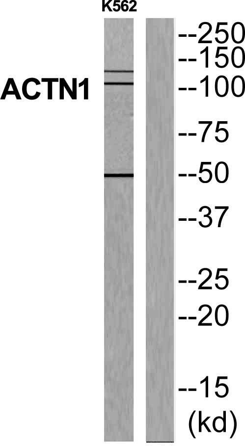 ACTN1 Antibody - Western blot analysis of extracts from K562 cells, using ACTN1 antibody.