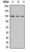 ACTN1 Antibody - Western blot analysis of ACTN1 expression in HepG2 (A); NIH3T3 (B); MCF7 (C) whole cell lysates.
