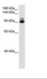 ACTN2 Antibody - Fetal Heart Lysate.  This image was taken for the unconjugated form of this product. Other forms have not been tested.