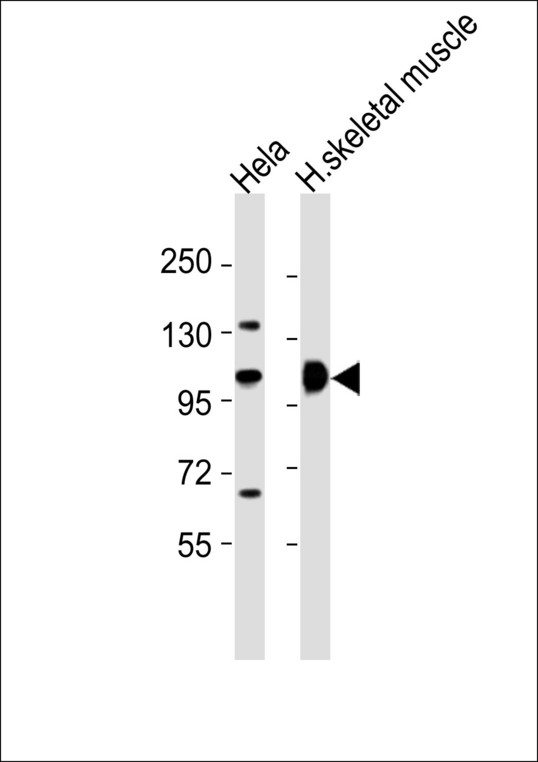 ACTN2 Antibody - All lanes : Anti-ACTN2 Antibody at 1:1000 dilution Lane 1: HeLa whole cell lysates Lane 2: human skeletal muscle lysates Lysates/proteins at 20 ug per lane. Secondary Goat Anti-Rabbit IgG, (H+L),Peroxidase conjugated at 1/10000 dilution Predicted band size : 104 kDa Blocking/Dilution buffer: 5% NFDM/TBST.