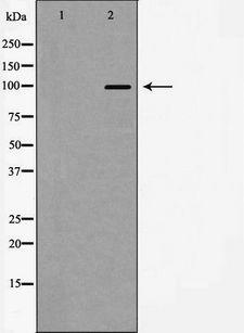 ACTN2 Antibody - Western blot analysis of Actinin a 2/3 expression in HeLa cells. The lane on the left is treated with the antigen-specific peptide.