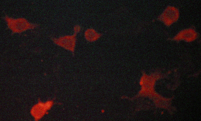 ACTN2 Antibody - Staining LOVO cells by IF/ICC. The samples were fixed with PFA and permeabilized in 0.1% saponin prior to blocking in 10% serum for 45 min at 37°C. The primary antibody was diluted 1/400 and incubated with the sample for 1 hour at 37°C. A Alexa Fluor® 594 conjugated goat polyclonal to rabbit IgG (H+L), diluted 1/600 was used as secondary antibody.