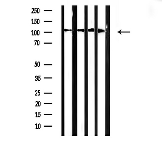 ACTN2 Antibody - Western blot analysis of Actin a-2/3 expression in various lysates