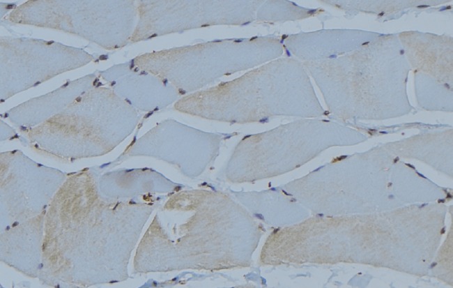 ACTN2 Antibody - 1:100 staining mouse muscle tissue by IHC-P. The sample was formaldehyde fixed and a heat mediated antigen retrieval step in citrate buffer was performed. The sample was then blocked and incubated with the antibody for 1.5 hours at 22°C. An HRP conjugated goat anti-rabbit antibody was used as the secondary.