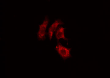 ACTN2 Antibody - Staining HepG2 cells by IF/ICC. The samples were fixed with PFA and permeabilized in 0.1% Triton X-100, then blocked in 10% serum for 45 min at 25°C. The primary antibody was diluted at 1:200 and incubated with the sample for 1 hour at 37°C. An Alexa Fluor 594 conjugated goat anti-rabbit IgG (H+L) antibody, diluted at 1/600, was used as secondary antibody.