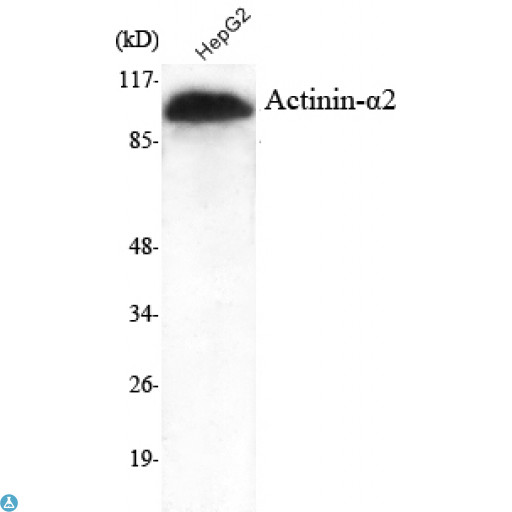 ACTN2 Antibody - Western Blot (WB) analysis using Actinin-alpha2 Monoclonal Antibody against HepG2 cell lysate.