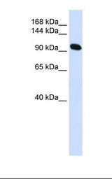 ACTN2 Antibody - Fetal muscle lysate. Antibody concentration: 1.0 ug/ml. Gel concentration: 6-18%.  This image was taken for the unconjugated form of this product. Other forms have not been tested.