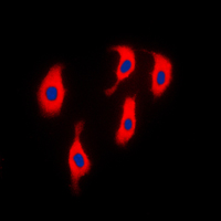 ACTN2 Antibody - Immunofluorescent analysis of ACTN2 staining in H9C2 cells. Formalin-fixed cells were permeabilized with 0.1% Triton X-100 in TBS for 5-10 minutes and blocked with 3% BSA-PBS for 30 minutes at room temperature. Cells were probed with the primary antibody in 3% BSA-PBS and incubated overnight at 4 C in a humidified chamber. Cells were washed with PBST and incubated with a DyLight 594-conjugated secondary antibody (red) in PBS at room temperature in the dark. DAPI was used to stain the cell nuclei (blue).