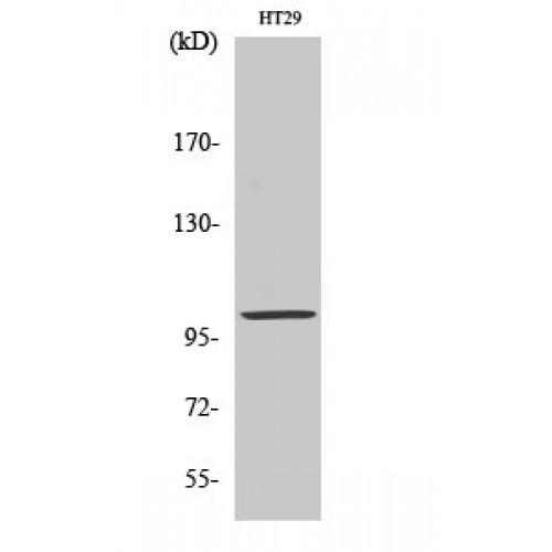 ACTN3 Antibody - Western blot of Actinin-alpha3 antibody