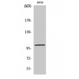 ACTN3 Antibody - Western blot of Actinin-alpha3 antibody
