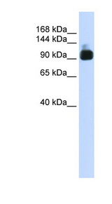 ACTN3 Antibody - ACTN3 antibody Western blot of Fetal Muscle lysate. This image was taken for the unconjugated form of this product. Other forms have not been tested.