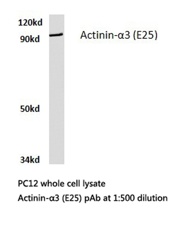 ACTN3 Antibody - Western blot of Actinin-3 (E25) pAb in extracts from PC12 cells.
