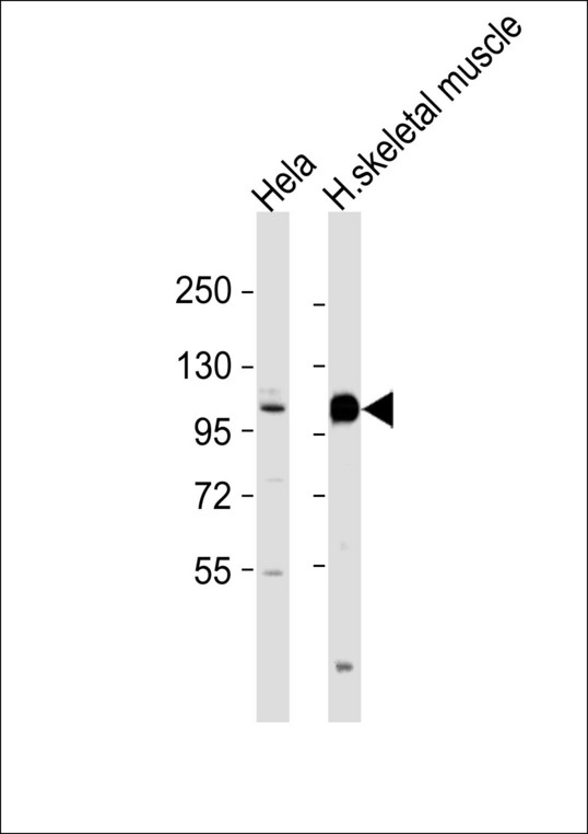 ACTN3 Antibody - All lanes : Anti-ACTN3 Antibody at 1:1000 dilution Lane 1: HeLa whole cell lysates Lane 2: human skeletal muscle lysates Lysates/proteins at 20 ug per lane. Secondary Goat Anti-Rabbit IgG, (H+L),Peroxidase conjugated at 1/10000 dilution Predicted band size : 103 kDa Blocking/Dilution buffer: 5% NFDM/TBST.