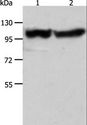 ACTN3 Antibody - Western blot analysis of Human fetal muscle tissue and HeLa cell, using ACTN3 Polyclonal Antibody at dilution of 1:400.