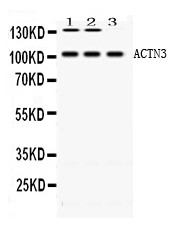 ACTN3 Antibody - Western blot - Anti-ACTN3/Alpha Actinin 3 Picoband Antibody