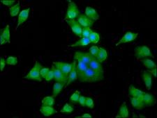 ACTN3 Antibody - Immunofluorescence staining of Hela cells diluted at 1:133, counter-stained with DAPI. The cells were fixed in 4% formaldehyde, permeabilized using 0.2% Triton X-100 and blocked in 10% normal Goat Serum. The cells were then incubated with the antibody overnight at 4°C.The Secondary antibody was Alexa Fluor 488-congugated AffiniPure Goat Anti-Rabbit IgG (H+L).