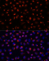 ACTN3 Antibody - Immunofluorescence analysis of HeLa cells using ACTN3 antibody at dilution of 1:100 (40x lens). Blue: DAPI for nuclear staining.