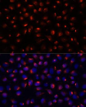 ACTN3 Antibody - Immunofluorescence analysis of HeLa cells using ACTN3 antibody at dilution of 1:100 (40x lens). Blue: DAPI for nuclear staining.