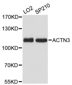 ACTN3 Antibody - Western blot analysis of extracts of various cell lines, using ACTN3 antibody at 1:3000 dilution. The secondary antibody used was an HRP Goat Anti-Rabbit IgG (H+L) at 1:10000 dilution. Lysates were loaded 25ug per lane and 3% nonfat dry milk in TBST was used for blocking. An ECL Kit was used for detection and the exposure time was 10s.