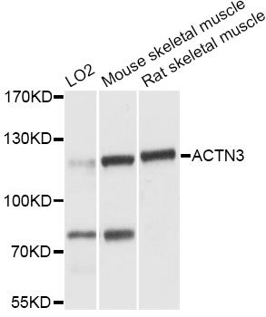 ACTN3 Antibody - Western blot analysis of extracts of various cell lines, using ACTN3 antibody at 1:3000 dilution. The secondary antibody used was an HRP Goat Anti-Rabbit IgG (H+L) at 1:10000 dilution. Lysates were loaded 25ug per lane and 3% nonfat dry milk in TBST was used for blocking. An ECL Kit was used for detection and the exposure time was 5s.