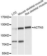 ACTN3 Antibody - Western blot analysis of extracts of various cell lines, using ACTN3 antibody at 1:3000 dilution. The secondary antibody used was an HRP Goat Anti-Rabbit IgG (H+L) at 1:10000 dilution. Lysates were loaded 25ug per lane and 3% nonfat dry milk in TBST was used for blocking. An ECL Kit was used for detection and the exposure time was 5s.