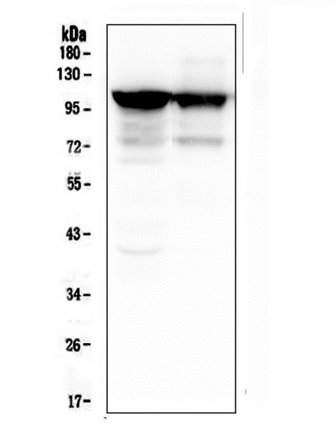 ACTN3 Antibody - Western blot analysis of ACTN3 using anti-ACTN3 antibody. Electrophoresis was performed on a 10% SDS-PAGE gel at 70V (Stacking gel) / 90V (Resolving gel) for 2-3 hours. The sample well of each lane was loaded with 50ug of sample under reducing conditions. Lane 1: rat skeletal muscle tissue, Lane 2: mouse skeletal muscle tissue. After Electrophoresis, proteins were transferred to a Nitrocellulose membrane at 150mA for 50-90 minutes. Blocked the membrane with 5% Non-fat Milk/ TBS for 1.5 hour at RT. The membrane was incubated with mouse anti-ACTN3 antigen affinity purified monoclonal antibody at 0.5 µg/mL overnight at 4°C, then washed with TBS-0.1% Tween 3 times with 5 minutes each and probed with a goat anti-mouse IgG-HRP secondary antibody at a dilution of 1:10000 for 1.5 hour at RT. The signal is developed using an Enhanced Chemiluminescent detection (ECL) kit with Tanon 5200 system.