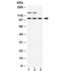 ACTN3 Antibody - Western blot testing of 1) rat skeletal muscle, 2) mouse skeletal muscle and 3) human HT080 lysate with ACTN3 antibody at 0.5ug/ml. Predicted molecular weight ~103 kDa.