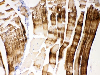 ACTN3 Antibody - IHC testing of FFPE mouse skeletal muscle with ACTN3 antibody at 1ug/ml. HIER: steam sections in pH6 citrate buffer for 20 min.