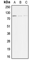 ACTN3 Antibody - Western blot analysis of ACTN3 expression in HeLa (A); mouse muscle (B); rat muscle (C) whole cell lysates.