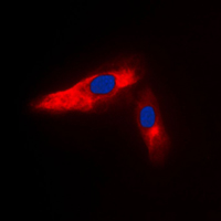 ACTN3 Antibody - Immunofluorescent analysis of ACTN3 staining in HeLa cells. Formalin-fixed cells were permeabilized with 0.1% Triton X-100 in TBS for 5-10 minutes and blocked with 3% BSA-PBS for 30 minutes at room temperature. Cells were probed with the primary antibody in 3% BSA-PBS and incubated overnight at 4 C in a humidified chamber. Cells were washed with PBST and incubated with a DyLight 594-conjugated secondary antibody (red) in PBS at room temperature in the dark. DAPI was used to stain the cell nuclei (blue).