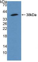 ACTN4 Antibody - Western Blot; Sample: Recombinant ACTN4, Human.