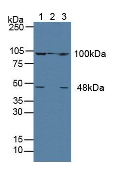 ACTN4 Antibody - Western Blot; Lane1: Human MCF-7 Cells; Lane2: Porcine Liver Tissue; Lane3: Human Hela Cells.