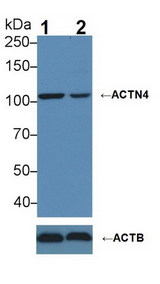 ACTN4 Antibody - Knockout Varification: Lane 1: Wild-type MCF7 cell lysate; Lane 2: ACTN4 knockout MCF7 cell lysate; Predicted MW: 104,79,59kDa ; Observed MW: 104kDa; Primary Ab: 3µg/ml Rabbit Anti-Human ACTN4 Antibody; Second Ab: 0.2µg/mL HRP-Linked Caprine Anti-Rabbit IgG Polyclonal Antibody;