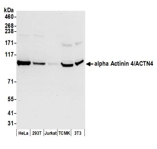 ACTN4 Antibody - Detection of human and mouse alpha Actinin 4/ACTN4 by western blot. Samples: Whole cell lysate (50 µg) from HeLa, HEK293T, Jurkat, mouse TCMK-1, and mouse NIH 3T3 cells prepared using NETN lysis buffer. Antibody: Affinity purified rabbit anti-alpha Actinin 4/ACTN4 antibody used for WB at 0.1 µg/ml. Detection: Chemiluminescence with an exposure time of 10 seconds.