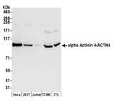 ACTN4 Antibody - Detection of human and mouse alpha Actinin 4/ACTN4 by western blot. Samples: Whole cell lysate (50 µg) from HeLa, HEK293T, Jurkat, mouse TCMK-1, and mouse NIH 3T3 cells prepared using NETN lysis buffer. Antibody: Affinity purified rabbit anti-alpha Actinin 4/ACTN4 antibody used for WB at 0.1 µg/ml. Detection: Chemiluminescence with an exposure time of 10 seconds.