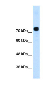 ACTN4 Antibody - ACTN4 / Alpha-Actinin-4 antibody ARP42202_T100-NP_004915-ACTN4(actinin, alpha 4) Antibody Western blot of HCT116 cell lysate.  This image was taken for the unconjugated form of this product. Other forms have not been tested.