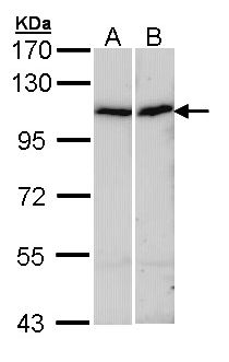 ACTN4 Antibody - Sample (30 ug of whole cell lysate). A: A431 , B: Hep G2 . 7.5% SDS PAGE. ACTN4 antibody diluted at 1:1000.