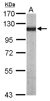 ACTN4 Antibody - Sample (50 ug of whole cell lysate). A: Mouse brain. 7.5% SDS PAGE. ACTN4 antibody diluted at 1:1000.