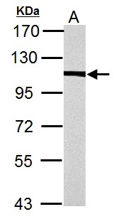 ACTN4 Antibody - alpha Actinin 4 antibody [N2C1], Internal detects alpha Actinin 4 protein by Western blot analysis. A. 30 ug PC-12 whole cell lysate/extract. 7.5% SDS-PAGE. alpha Actinin 4 antibody [N2C1], Internal dilution:1:3000.