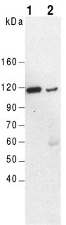 ACTN4 Antibody - Western Blot of mouse kidney (lane 1) and brain (lane 2) using anti-alpha-Actinin-4, pAb (IG-701). Tissue: 25 ug each; Antibody (dilution 1:2500) for 2h at RT; Detection method: ECL.