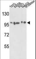 ACTN4 Antibody - Western blot of ACTN4 Antibody in T47D, A2058, A375, HepG2 cell line and mouse bladder tissue lysates (35 ug/lane). ACTN4 (arrow) was detected using the purified antibody.