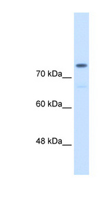 ACTN4 Antibody - ACTN4 / Alpha-Actinin-4 antibody ARP42203_P050-NP_004915-ACTN4(actinin, alpha 4) Antibody Western blot of HCT116 cell lysate.  This image was taken for the unconjugated form of this product. Other forms have not been tested.