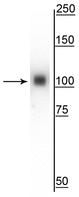 ACTN4 Antibody - Western blot of mouse whole brain lysate showing specific immunolabeling of the ~105 kDa a-actinin 4 protein.