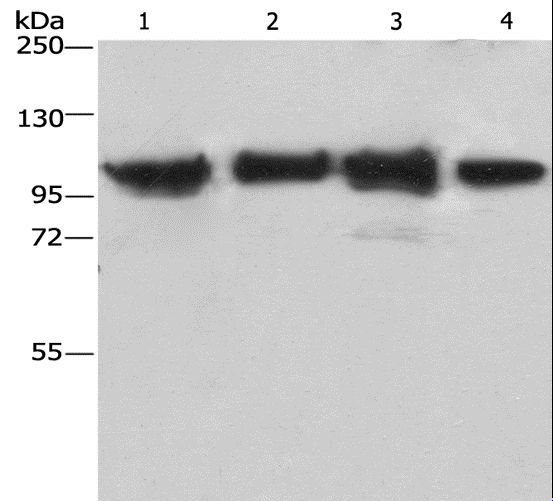ACTN4 Antibody - Western blot analysis of Lovo cell and mouse kidney tissue, 231 and hepG2 cell, using ACTN4 Polyclonal Antibody at dilution of 1:485.